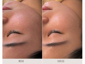 リッシュ 骨盤革命(RICHE.)/牛込神楽坂/韓国肌管理/美容整体