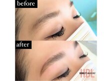 ラビット(Lovit)/ハリウッドブロウリフト