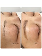 ヒーミー(Hymy)/パリジェンヌブロウリフト