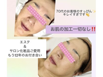 メルスィ(Merci)の写真