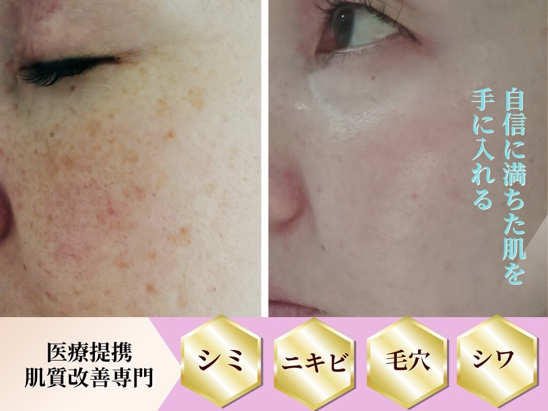 ☆azu様・専門ページ☆ 【公式通販】