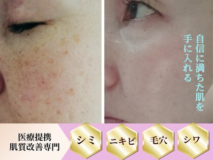 アズ(AZU)の写真