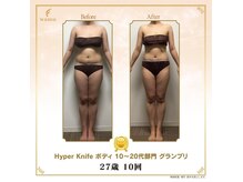 ビハース(Salon BEHARS)の雰囲気（馬橋エリア唯一のハイパーナイフシリーズコンプリートサロン！）