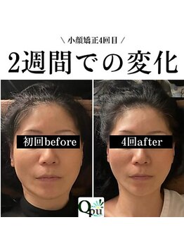 キュープ 鹿児島伊集院店(Qpu)/