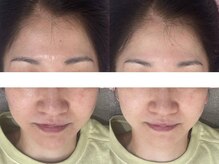 シミケア専門店 SAKURA 平塚店/