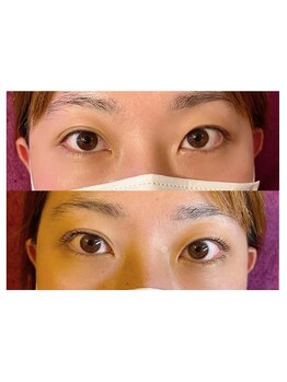 シャンティ(Shanti)/パリジェンヌラッシュリフト