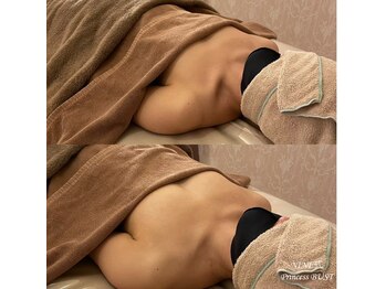 プレミドール(PREMIDOLL)/驚きのバストアップ効果♪