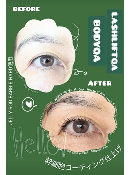 ボディキュア(BODYQA)/次世代ラッシュリフト