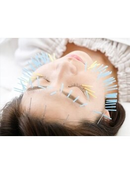 鍼灸施術を受けたい