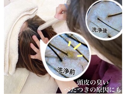 プラチナムスーパースカルプ 宮崎市店(PLATINUMスーパースカルプ)の写真