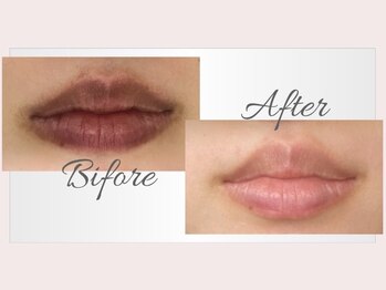 エクラ(eclat)/ローマピンク