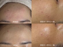 期待を裏切らない驚愕の結果とキレイになり続ける施術をお届け♪