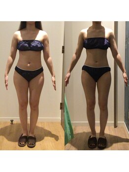 アユアランリンク 札幌店/20代/約2ヵ月/-4.5kg/全身痩せ