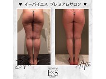 満足度◎本格小顔コルギと話題のレモンボトル憧れの黄金比美人へ