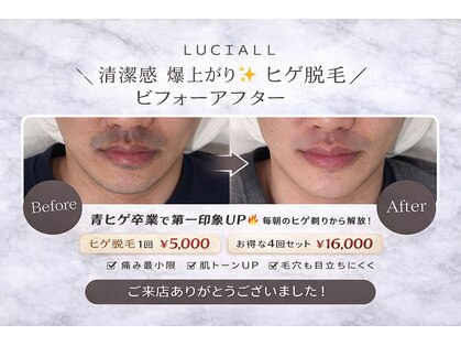 ルシアル(LUCIALL)の写真