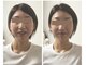 小顔専門サロン ラリューシュ(La ruche)の写真/憧れのキュッと引き締まった立体的な小顔を実現！目元もパッチリ＆鼻筋もシュッ◎埋もれた輪郭もスッキリ♪