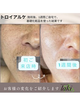 リラクゼーションサロン ラキ(laki)/トライアルケの基礎化粧品