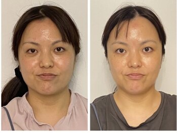 ハイファイブ(Hi-Five)/ポテンツァ/（施術25回）