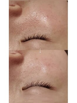 ラエッセ 恵比寿(LAESSE)/毛穴・美白専門店 LAESSE 恵比寿