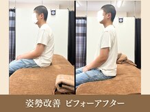 オリエンタル整体院 新潟院/20代 SE 猫背改善成果