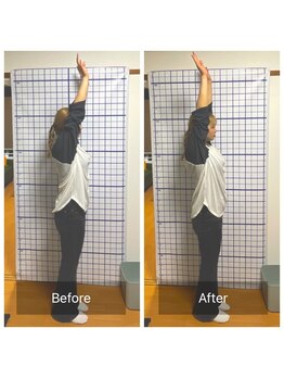 幸鍼灸整体院 武庫之荘院/整体・トレーニング・姿勢変化7