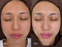 アウラ 小杉店(AULA)/ララピール☆