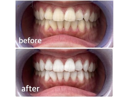 エクシアホワイト 立川南口店の写真