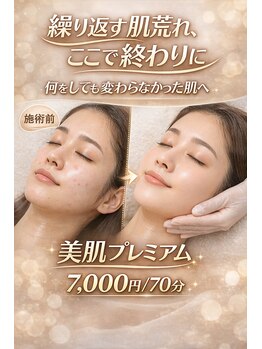 アプロ(Aphro)/肌荒れここで終わり