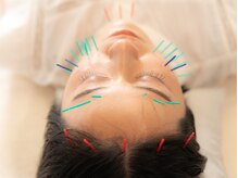 鍼綺の雰囲気（お肌の曲がり角を感じる大人女性のための本格美容鍼。）