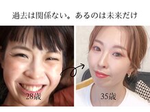 ディアンヌ(Diane)の雰囲気（[衝撃before＆after]産後マイナス19kg！見た目年齢マイナス9歳！）