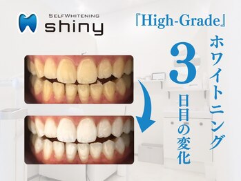 ホワイトニングサロン シャイニー 浜松細島店(shiny)/【超絶・美・白】ホワイトニング