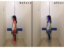 今津ぴっと骨盤整体院/ビフォーアフター4