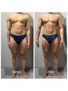 アーヒル(A”-HILU)/筋膜リリース