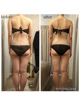 リープ(Lieb)/ボディビフォーアフター