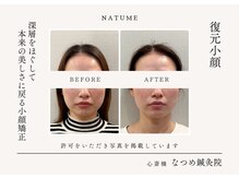 お顔と体のコリをほぐして本来の美しさに戻る小顔矯正