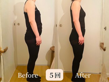 ロシュニ/30代 お悩み:小顔/姿勢改善/痩身