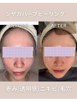 エン(enn.)/シヤカハーブピーリングでツヤ肌