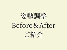 モビ(mobi)/猫背改善　姿勢改善　姿勢整体