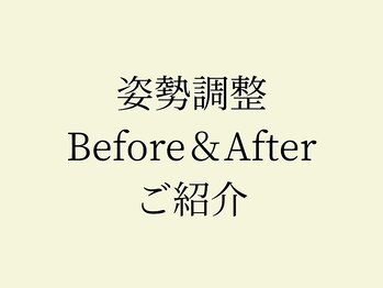 モビ(mobi)/猫背改善　姿勢改善　姿勢整体