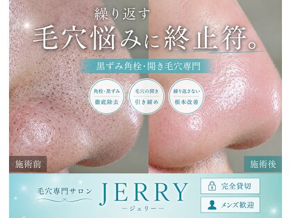 ジェリー(JERRY)の写真