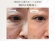 エステリワール|韓国肌管理・韓国育毛促進ケア・小顔・毛穴・脱毛・シワたるみの写真