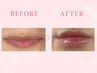 【近隣割引実地中！！】話題の最先端施術ローマピンク☆口紅いらずのLIPへ♪