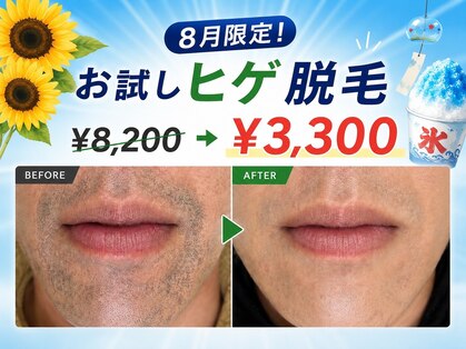 ビビの写真