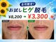 ビビの写真