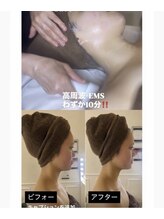 ビ フェイス(Bi-face)/