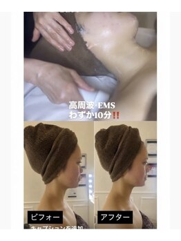 ビ フェイス(Bi-face)/