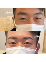 ワオ(wao)/parisienne brow lift