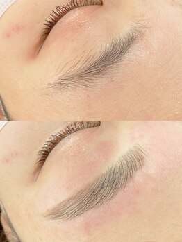 シュエット(Chouette)/ハリウッドブロウリフト