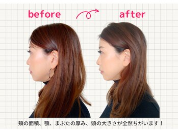 ナチュラルハリー(NaturalHarry)/当サロン自慢の経絡小顔施術!