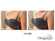 シャルムココ 蔵前店(CharmeCoCo)/お客様Before→After